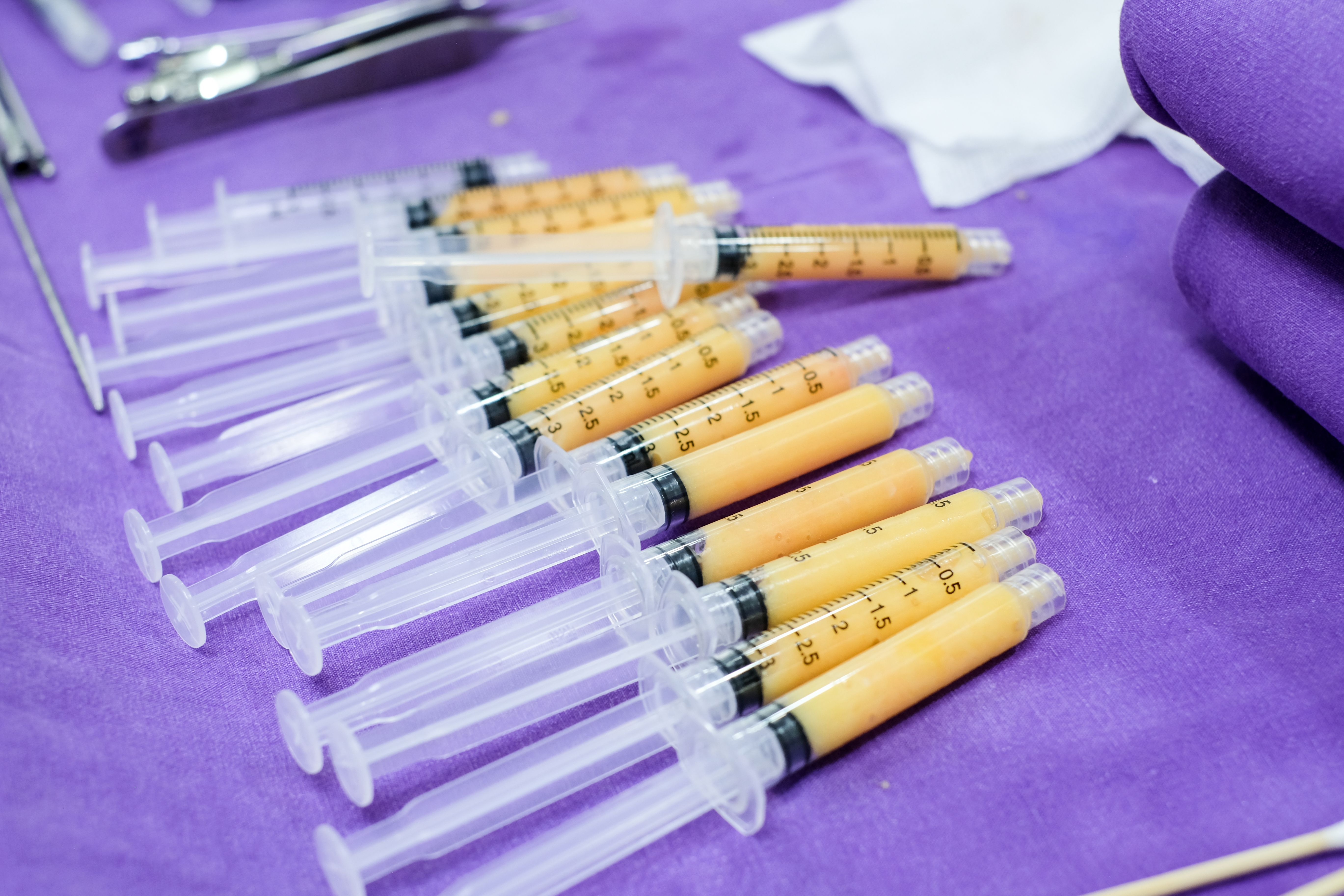 fatgrafting: nanofatinjections:microfatinjections:plasticsurgeons.jpg